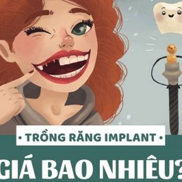 Giá ghép Implant tại Pleiku, Gia Lai là bao nhiêu?