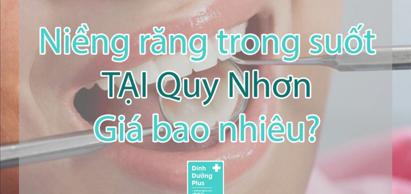 Giá niềng răng trong suốt tại Quy Nhơn, Bình Định 1 lần bao nhiêu?