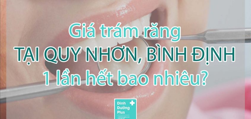 Giá trám răng tại Quy Nhơn, Bình Định 1 lần hết bao nhiêu?