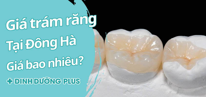 Giá trám răng tại Đông Hà bao nhiêu?