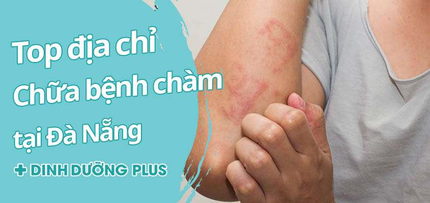 Top 7 bác sĩ chữa bệnh chàm da tại Đà Nẵng