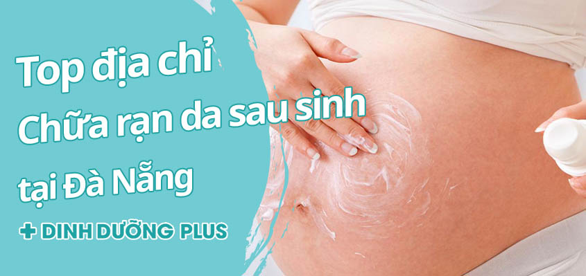 Top 7 địa chỉ điều trị rạn da sau sinh tại Đà Nẵng