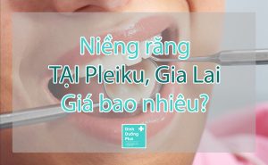 Giá niềng răng tại Pleiku, Gia Lai 1 lần là bao nhiêu