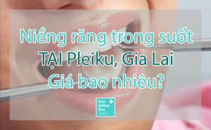 Giá niềng răng trong suốt tại Pleiku Gia Lai