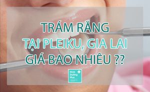 Giá trám răng tại Pleiku Gia Lai