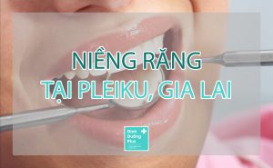 NIỀNG RĂNG TẠI PLEIKU, GIA LAI