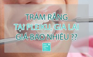 TRỒNG IMPLANT Pleiku, Gia lai GIÁ BAO NHIEU