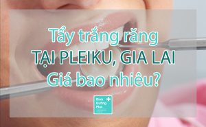 Tẩy trắng răng tại Pleiku, Gia Lai