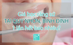 giá bọc răng sứ tại quy nhơn, bình định 1 lần hết bao nhiêu