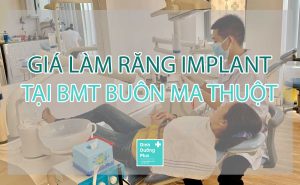 Giá làm răng implant tại BMT Buôn Ma Thuột