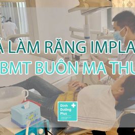 Giá làm răng implant tại BMT Buôn Ma Thuột