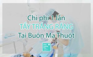 Giá tẩy trắng răng tại BMT (Buôn Ma Thuột) 1 lần bao nhiêu?