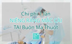 Niềng răng mắc cài tại BMT (Buôn Ma Thuột) 1 lần giá bao nhiêu