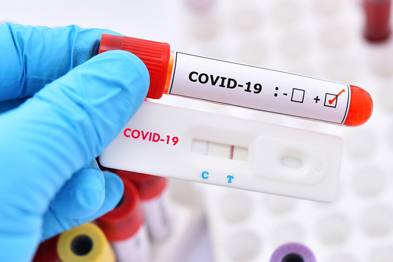 giá xét nghiệm kháng thể covid tại đà nẵng