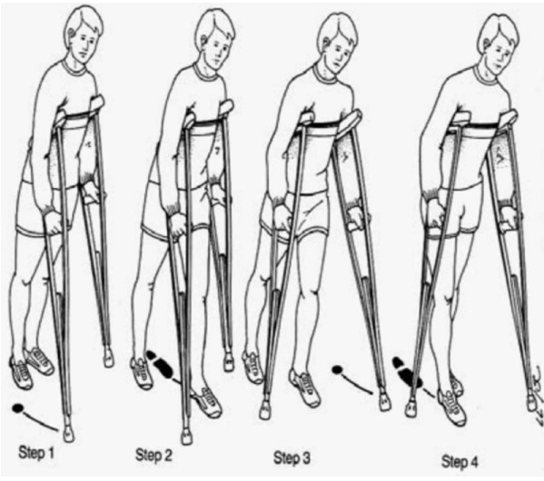 Cửa hàng bán nạng nhôm tại Đà Nẵng
