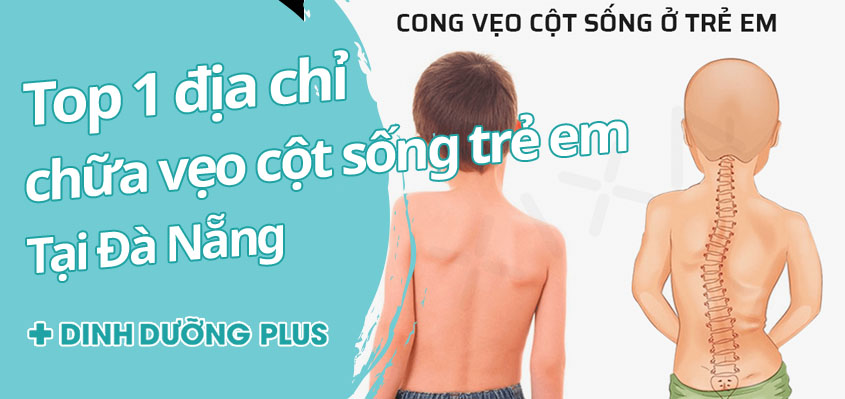 địa chỉ chữa vẹo cột sống trẻ em tại đà nẵng