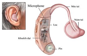 máy trợ thính tại Đông Hà, Quảng Trị 1